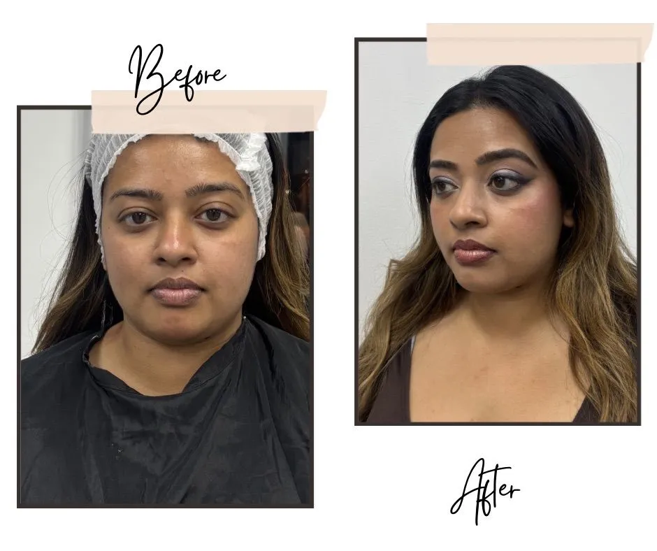 Before-and-after composition showing a person in a black garment with a hair covering in the Before photo and with uncovered hair in the After photo.